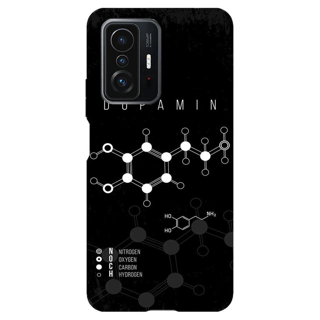 Husa compatibila cu Xiaomi 11T model Dream Lake, Silicon, TPU, Viceversa - Viceversa